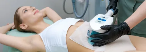 SmartLipo Laser Liposuction in The Spring, TX